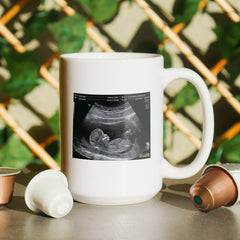 Daddy Baby Ultrasound Coffee Mug - CustomKings - 